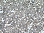 S100A14 Antibody in Immunohistochemistry (Paraffin) (IHC (P))