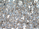 S100A14 Antibody in Immunohistochemistry (Paraffin) (IHC (P))