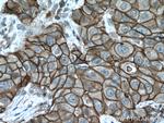 S100A14 Antibody in Immunohistochemistry (Paraffin) (IHC (P))