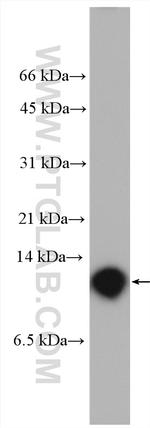 S100A14 Antibody in Western Blot (WB)