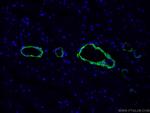 transgelin/SM22 Antibody in Immunohistochemistry (PFA fixed) (IHC (PFA))