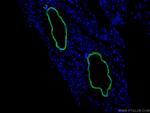 transgelin/SM22 Antibody in Immunohistochemistry (PFA fixed) (IHC (PFA))