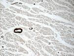 transgelin/SM22 Antibody in Immunohistochemistry (Paraffin) (IHC (P))