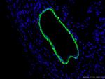 transgelin/SM22 Antibody in Immunohistochemistry (PFA fixed) (IHC (PFA))