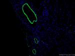 transgelin/SM22 Antibody in Immunohistochemistry (PFA fixed) (IHC (PFA))