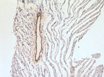 transgelin/SM22 Antibody in Immunohistochemistry (Paraffin) (IHC (P))