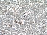 transgelin/SM22 Antibody in Immunohistochemistry (Paraffin) (IHC (P))