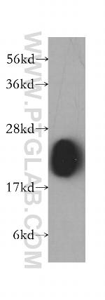 transgelin/SM22 Antibody in Western Blot (WB)