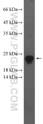 transgelin/SM22 Antibody in Western Blot (WB)