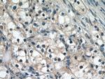 PIN1 Antibody in Immunohistochemistry (Paraffin) (IHC (P))