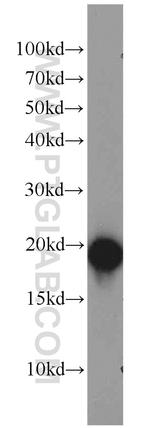 SNCB Antibody in Western Blot (WB)