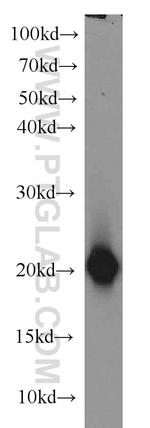 SNCB Antibody in Western Blot (WB)