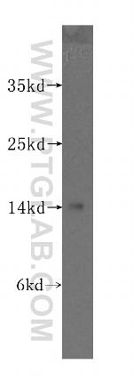 SNCB Antibody in Western Blot (WB)