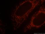 SNCB Antibody in Immunocytochemistry (ICC/IF)