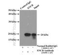 SNCB Antibody in Immunoprecipitation (IP)