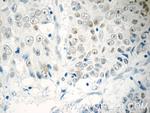 TFII I Antibody in Immunohistochemistry (Paraffin) (IHC (P))