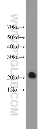 ASC/TMS1 Antibody in Western Blot (WB)