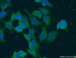 ASC/TMS1 Antibody in Immunocytochemistry (ICC/IF)