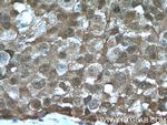 ASC/TMS1 Antibody in Immunohistochemistry (Paraffin) (IHC (P))