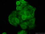 PSAT1 Antibody in Immunocytochemistry (ICC/IF)