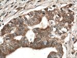 PSAT1 Antibody in Immunohistochemistry (Paraffin) (IHC (P))