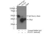 PSAT1 Antibody in Immunoprecipitation (IP)