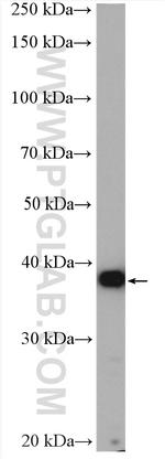 PSAT1 Antibody in Western Blot (WB)