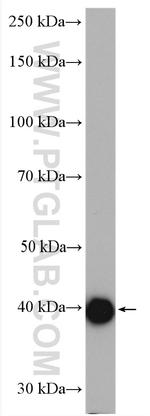 PSAT1 Antibody in Western Blot (WB)