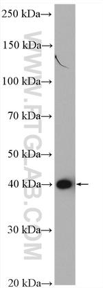 PSAT1 Antibody in Western Blot (WB)