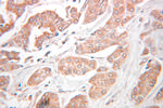 KEAP1 Antibody in Immunohistochemistry (Paraffin) (IHC (P))