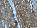 KEAP1 Antibody in Immunohistochemistry (Paraffin) (IHC (P))