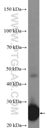 GSTA2 Antibody in Western Blot (WB)