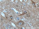 NCS1 Antibody in Immunohistochemistry (Paraffin) (IHC (P))