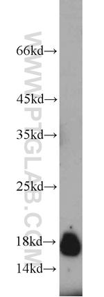 SURVIVIN Antibody in Western Blot (WB)