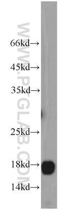 SURVIVIN Antibody in Western Blot (WB)