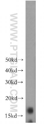 SURVIVIN Antibody in Western Blot (WB)