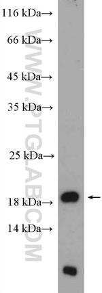 SURVIVIN Antibody in Western Blot (WB)