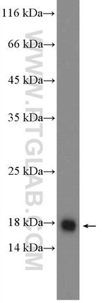 SURVIVIN Antibody in Western Blot (WB)