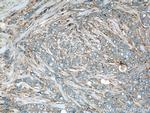 RhoGDI Antibody in Immunohistochemistry (Paraffin) (IHC (P))