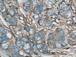 RhoGDI Antibody in Immunohistochemistry (Paraffin) (IHC (P))