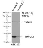 RhoGDI Antibody in Western Blot (WB)