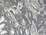 RhoGDI Antibody in Immunohistochemistry (Paraffin) (IHC (P))