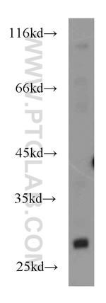 RhoGDI Antibody in Western Blot (WB)