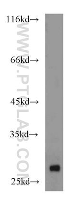 RhoGDI Antibody in Western Blot (WB)