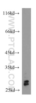 RhoGDI Antibody in Western Blot (WB)