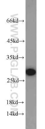 RhoGDI Antibody in Western Blot (WB)