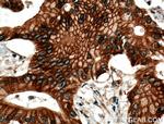 BLK Antibody in Immunohistochemistry (Paraffin) (IHC (P))