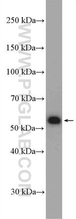 BLK Antibody in Western Blot (WB)