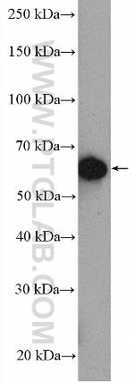 BLK Antibody in Western Blot (WB)