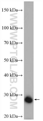 UCK2 Antibody in Western Blot (WB)